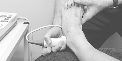 Ankle Pain